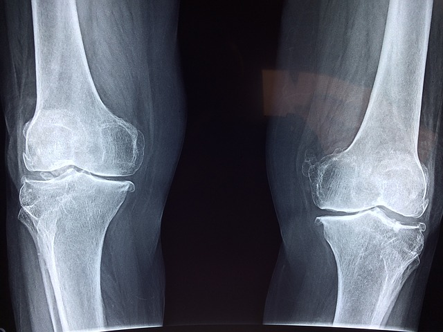 Definitions: Orthopedic Injury